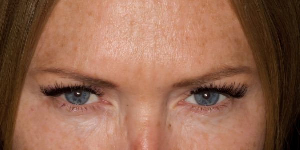 Case 1 Anti-wrinkle After