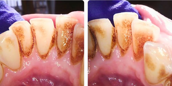 Case 6 Airflow before